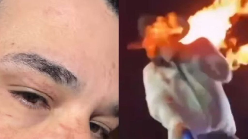 Cantor Léo é atingido por fogo