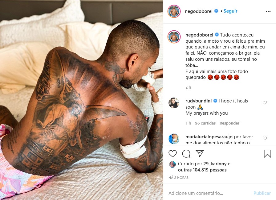 Apesar de ter o corpo bem machucado pelo acidente de moto, o cantor chocou os seguidores ao mostrar que tatuagem religiosa permaneceu intacta