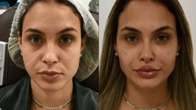 Sarah Andrade faz harmonização facial após saída do BBB21