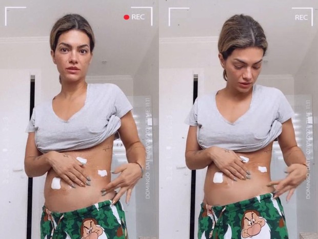 Kelly Key mostra a recuperação após cirurgia - Crédito: Reprodução / Instagram