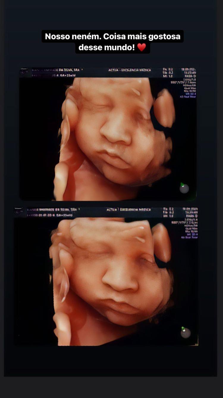 Bianca Andrade mostra rostinho do filho em ultrassom