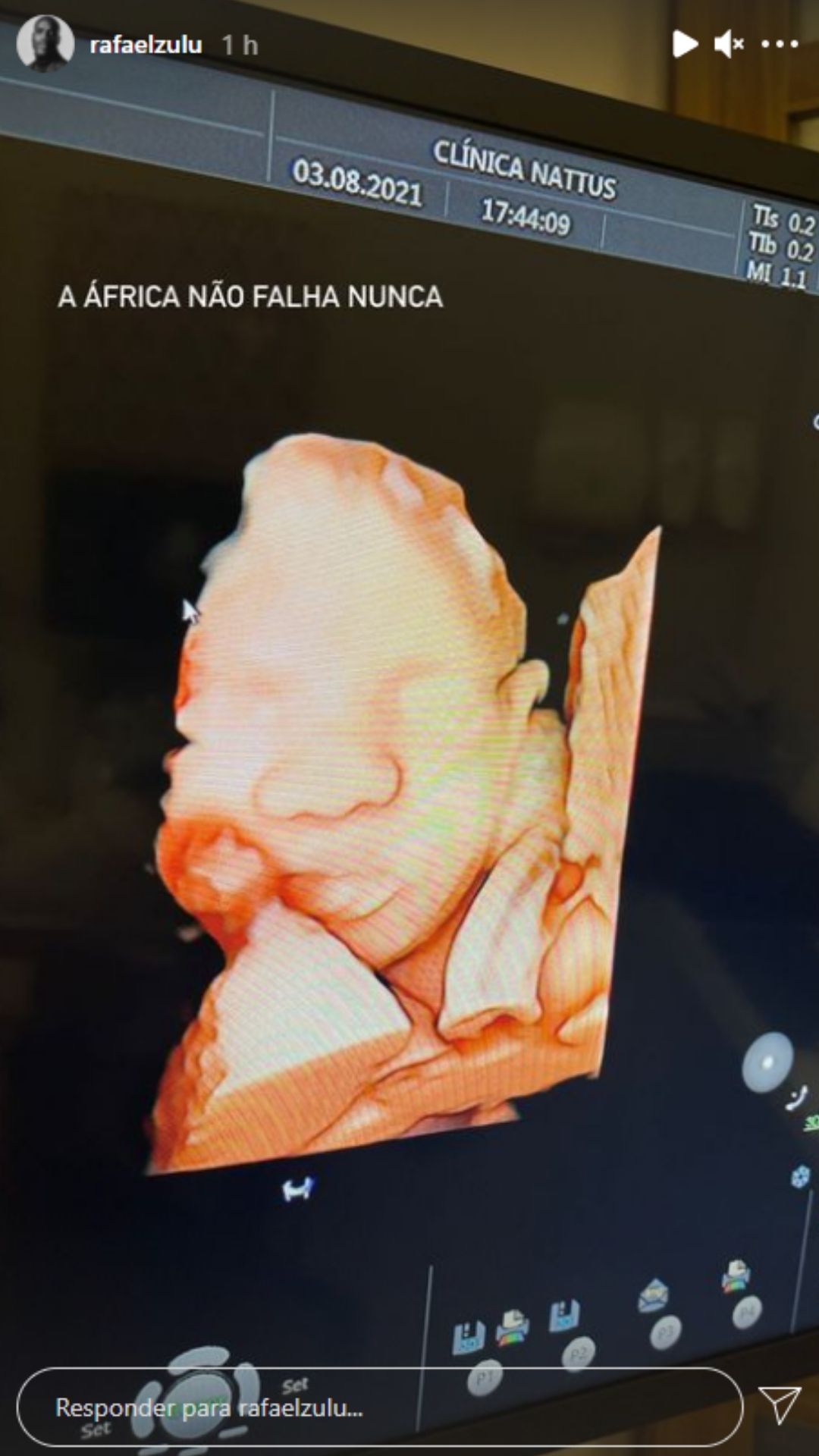 O ator Rafael mostrou rosto do filho no ultrassom. Foto: Reprodução/Instagram