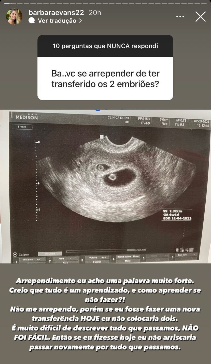 Bárbara Evans comenta sobre detalhes da gravidez - Crédito: Reprodução / Instagram