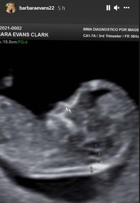 Bárbara Evans mostra ultrassom do primeiro filho - Crédito: Reprodução / Instagram