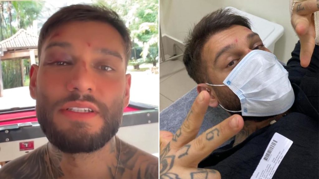 Lucas Lucco revela que sofreu queda em casa - Crédito: Reprodução / Instagram