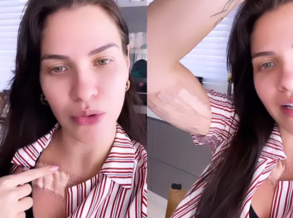 Andressa Suita remove tatuagens - Crédito: Reprodução / Instagram