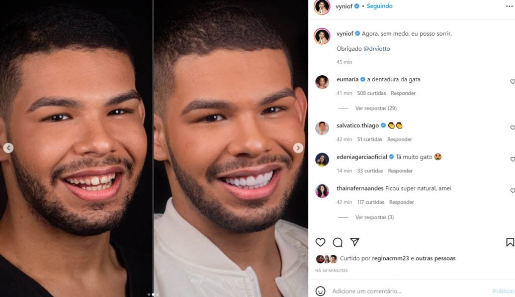 Ex-BBB Vyni mostra 'antes e depois' dos seus dentes - Crédito: Reprodução / Instagram