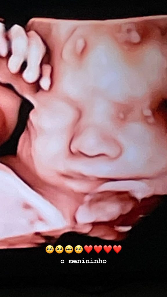 Isabella Scherer exibe rostinho do filho em ultrassom 3D