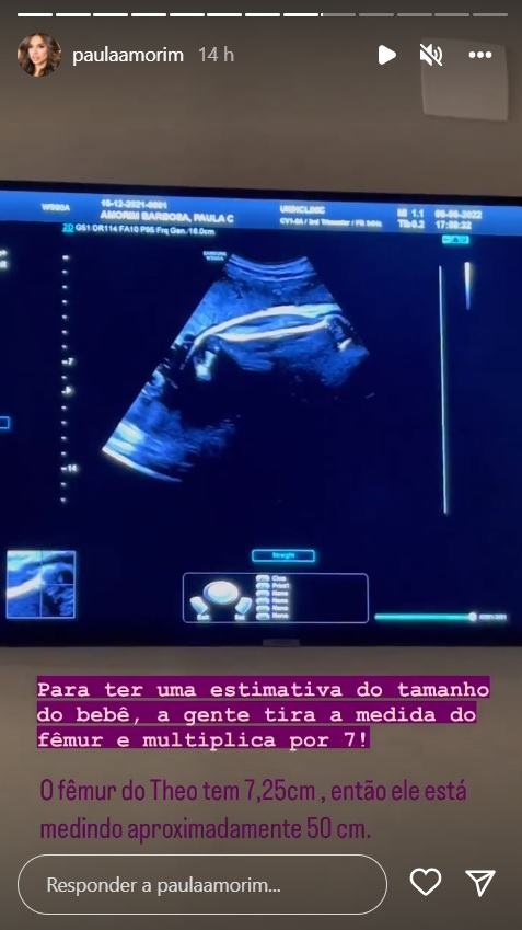 Paula Amorim se surpreende com novo ultrassom