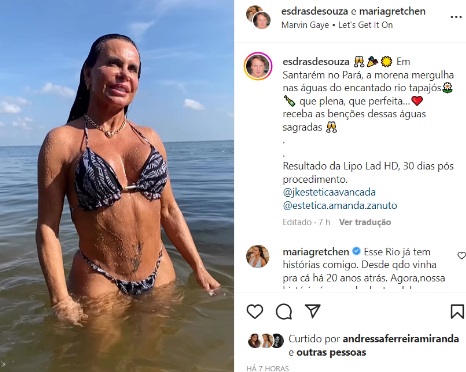 De biquíni fininho, Gretchen impressiona ao exibir o resultado da lipoaspiração HD