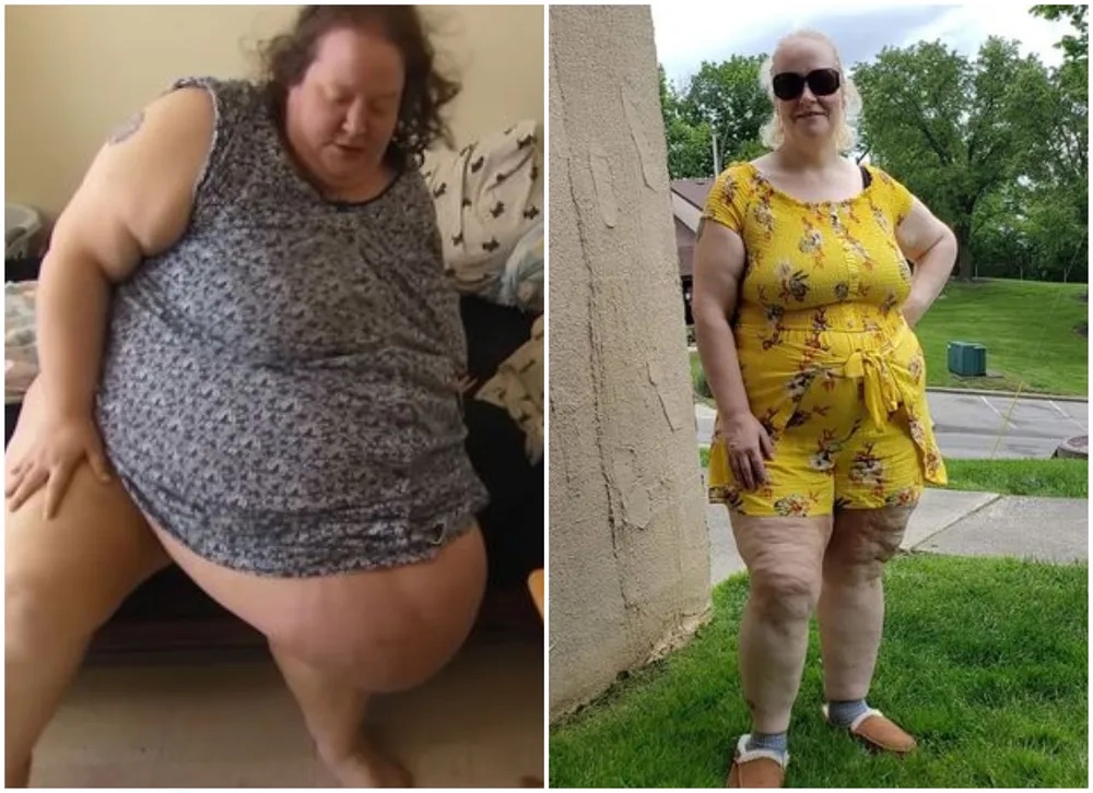 Irreconhecível! Estrela de reality show mostra corpo após perder 110 quilos