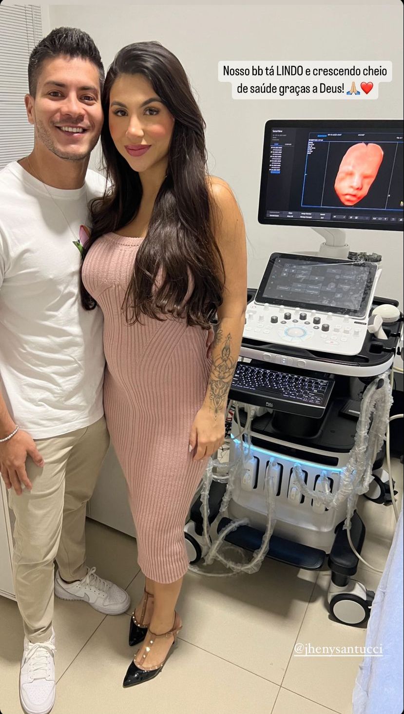 Arthur Aguiar e Jheny Santucci compartilham ultrassom do bebê. Foto: Reprodução/Instagram