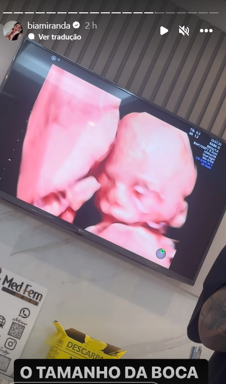 Grávida, Bia Miranda mostra rostinho do bebê em ultrassom