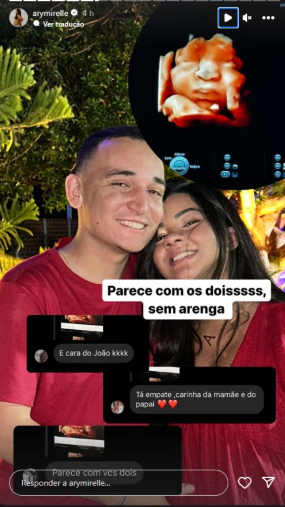 Story de Ary Mirelle - Reprodução/Instagram