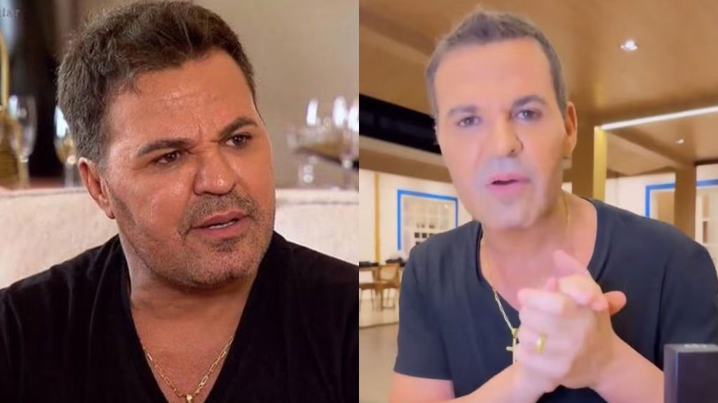 Antes e depois Eduardo Costa - Reprodução/Instagram