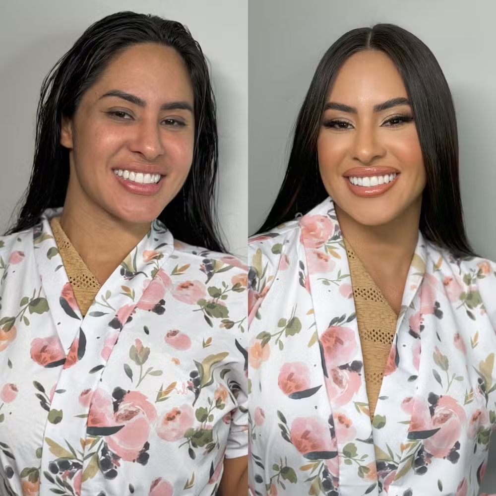 Antes e depois de Isabelle - Reprodução/Instagram