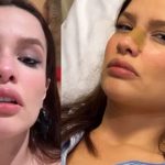 Juliette fratura o nariz - Reprodução/Instagram
