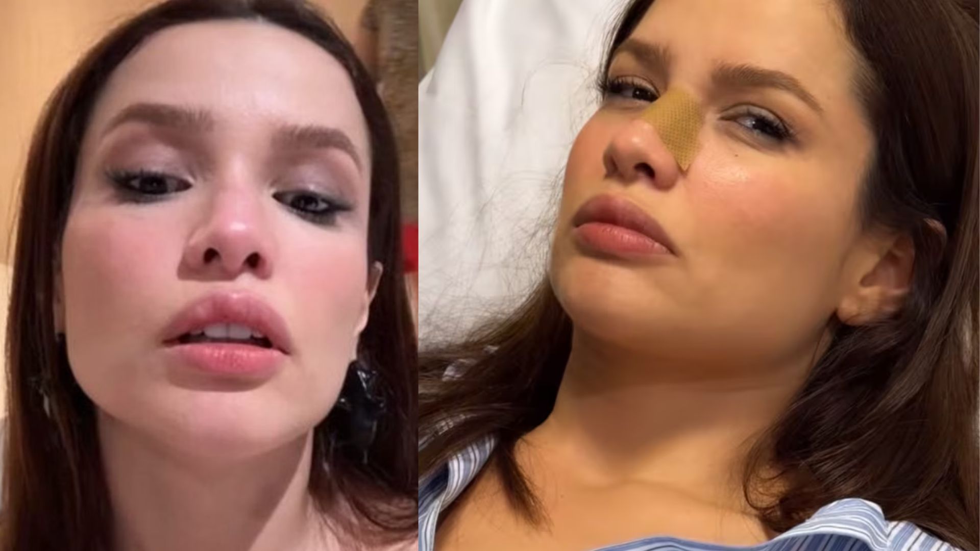 Juliette fratura o nariz - Reprodução/Instagram